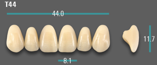 [VIABA35VT44] VITA VIONIC VIGO Anterior, A3.5, T44