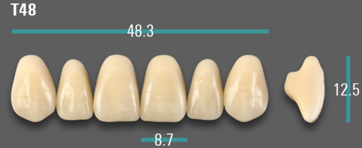 [VIABA35VT48] VITA VIONIC VIGO Anterior, A3.5, T48