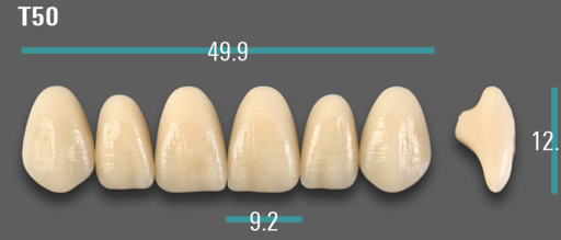 [VIABD3VT50] VITA VIONIC VIGO Anterior, D3, T50